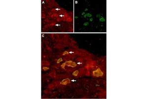 Immunohistochemistry (IHC) image for anti-Transient Receptor Potential Cation Channel, Subfamily V, Member 6 (TRPV6) (AA 712-725), (Intracellular) antibody (ABIN7043857)
