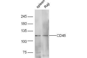 Lane 1: Mouse spleen lysates; Lane 2: Human raji lysates probed with Rabbit Anti-CD45 Polyclonal Antibody, Unconjugated  at 1:5000 for 90 min at 37˚C. (CD45 抗体  (AA 1210-1304))