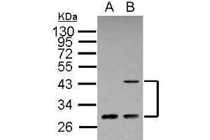 WB Image Sample (30 ug of whole cell lysate) A: A431 B: HeLa 12% SDS PAGE antibody diluted at 1:500 (ING1 抗体  (C-Term))
