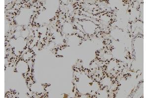 ABIN6277041 at 1/100 staining Rat lung tissue by IHC-P. (LHX8 抗体  (Internal Region))
