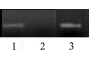 Histone H3 monomethyl Lys4 antibody (mAb) tested by ChIP. (Histone 3 抗体  (H3K4me))