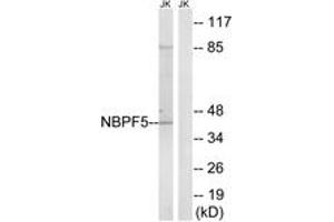 Western blot analysis of extracts from Jurkat cells, using NBPF5 Antibody. (NBPF5 抗体  (AA 302-351))