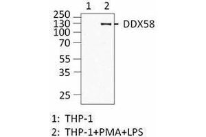 Western Blotting (WB) image for anti-DEAD (Asp-Glu-Ala-Asp) Box Polypeptide 58 (DDX58) antibody (ABIN2664928) (DDX58 抗体)
