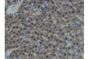 Detection of AST in Rat Liver Tissue using Polyclonal Antibody to Aspartate Aminotransferase (AST) (GOT1 抗体  (AA 1-413))