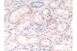 Detection of CTSG in Human Kidney Tissue using Polyclonal Antibody to Cathepsin G (CTSG) (Cathepsin G 抗体  (AA 21-255))