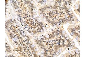 ABIN6263157 and ABIN6273006 at 1/100 staining Rat colon tissue by IHC-P. (MCM10 抗体  (C-Term))
