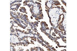 IHC analysis of VAPB using anti-VAPB antibody (ABIN5693292). (VAPB 抗体  (AA 2-55))