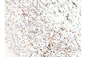 Immunohistochemistry (IHC) image for anti-Receptor tyrosine-protein kinase erbB-2 (ErbB2/Her2) (pTyr1112) antibody (ABIN6255774)