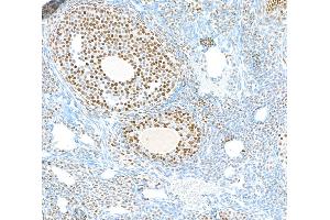 Immunohistochemistry (IHC) image for anti-Poly (ADP-Ribose) Polymerase 1 (PARP1) (AA 750-800) antibody (ABIN7449531) (Recombinant PARP1 抗体  (AA 750-800))