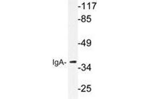 Western blot analysis of IgA antibody in extracts from HeLa cells. (兔 anti-人 IgA Antibody)