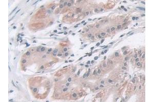 Detection of IDH2 in Human Stomach Tissue using Polyclonal Antibody to Isocitrate Dehydrogenase 2, mitochondrial (IDH2) (IDH2 抗体  (AA 40-452))
