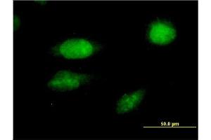 Immunofluorescence (IF) image for anti-Forkhead Box C2 (MFH-1, Mesenchyme Forkhead 1) (FOXC2) (AA 421-501) antibody (ABIN560913)