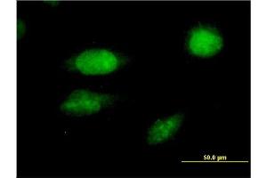 Immunofluorescence of monoclonal antibody to FOXC2 on HeLa cell.