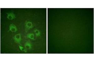 Immunofluorescence analysis of HuvEc cells, using CrkL (Phospho-Tyr207) Antibody. (CrkL 抗体  (pTyr207))