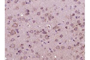 Paraformaldehyde-fixed, paraffin embedded rat brain tissue, Antigen retrieval by boiling in sodium citrate buffer (pH6. (Glucagon Receptor 抗体  (AA 11-110))