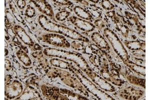 ABIN6260151 and ABIN6279148 at 1/100 staining Human kidney tissue by IHC-P. (ATXN7L1 抗体)