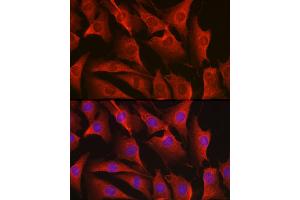 Immunofluorescence (IF) image for anti-V-Erb-A erythroblastic Leukemia Viral Oncogene Homolog 4 (Avian) (ERBB4) (AA 26-160) antibody (ABIN6140257)