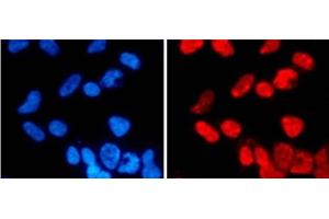 Immunofluorescence analysis of 293T cells using DiMethyl-Histone H3-K27 Polyclonal Antibody (Histone 3 抗体  (2meLys27))