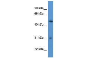 WB Suggested Anti-ROPN1L Antibody Titration: 0. (ROPN1L 抗体  (C-Term))