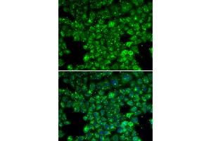 Immunofluorescence analysis of U2OS cells using LYZL6 antibody. (LYZL6 抗体)