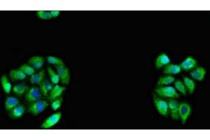 Immunofluorescent analysis of PC-3 cells using ABIN7146203 at dilution of 1:100 and Alexa Fluor 488-congugated AffiniPure Goat Anti-Rabbit IgG(H+L) (OB Cadherin 抗体  (AA 637-796))