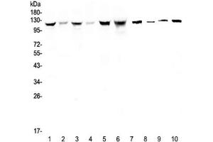 Western blot testing of human 1) HeLa, 2) placenta, 3) COLO-320, 4) HepG2, 5) SGC-7901, 6) Jurkat, 7) rat stomach, 8) mouse skeletal muscle, 9) mouse stomach and 10) mouse brain lysate with IDE antibody at 0. (IDE 抗体)