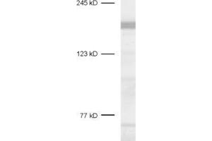dilution: 1 : 1000, sample: rat brain homogenate (CASKIN1 抗体  (AA 1416-1430))