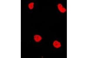 Immunofluorescent analysis of RAD54L2 staining in MCF7 cells. (ARIP4 抗体)