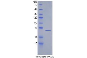 SDS-PAGE analysis of Human aZGP1 Protein. (AZGP1 蛋白)