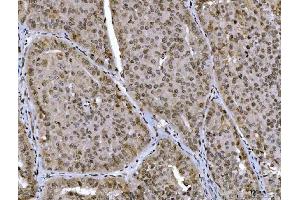 IHC analysis of CTBP2 using anti-CTBP2 antibody (ABIN7601326). (CTBP2 抗体  (AA 321-445))