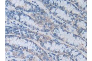 IHC-P analysis of Mouse Small intestine Tissue, with DAB staining. (HPSE 抗体  (AA 353-464))