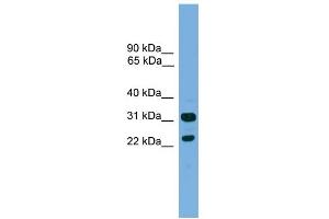 WB Suggested Anti-CD8B Antibody Titration:  0. (CD8B 抗体  (Middle Region))