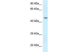 Western Blotting (WB) image for anti-Sparc/osteonectin, Cwcv and Kazal-Like Domains Proteoglycan (Testican) 2 (SPOCK2) (N-Term) antibody (ABIN2789077)