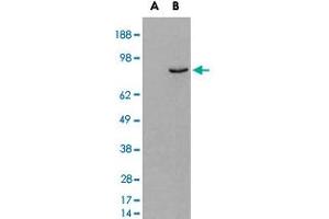 HEK293 overexpressing human PDE4B and probed with PDE4B polyclonal antibody  (mock transfection in first lane), tested by Origene. (PDE4B 抗体)