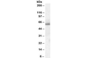 Western blot testing of human tonsil lysate with SH2D3A antibody at 0.
