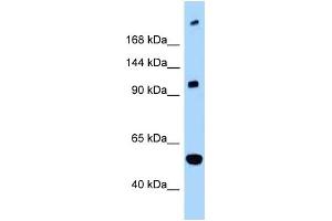 WB Suggested Anti-L1CAM Antibody Titration: 1. (L1CAM 抗体  (C-Term))