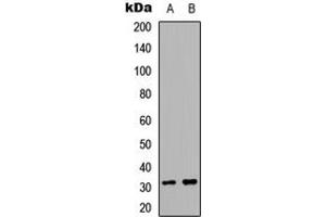 Western blot analysis of ACER2 expression in A549. (ACER2 抗体  (Center))