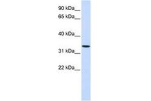 Image no. 1 for anti-Wingless-Type MMTV Integration Site Family, Member 6 (WNT6) (AA 252-301) antibody (ABIN6740986) (WNT6 抗体  (AA 252-301))