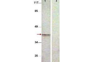 Aurora Kinase B 抗体  (pThr232)