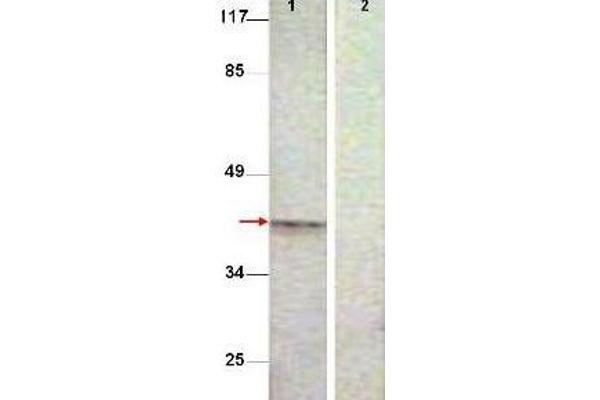 Aurora Kinase B 抗体  (pThr232)