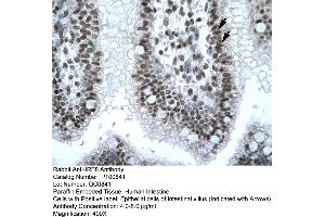Immunohistochemistry with Human Intestine tissue (IRF8 抗体  (N-Term))
