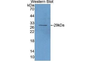 Western Blotting (WB) image for anti-Interleukin 2 Receptor, alpha (IL2RA) (AA 22-243) antibody (ABIN1862763) (CD25 抗体  (AA 22-243))