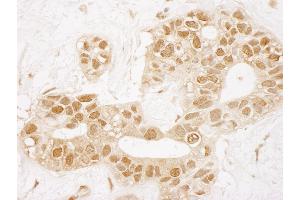 Immunohistochemistry (IHC) image for anti-TP53 induced glycolysis regulatory phosphatase (TIGAR) (AA 220-270) antibody (ABIN7448835)