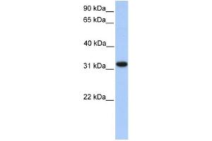 WB Suggested Anti-ETFA Antibody Titration: 0. (ETFA 抗体  (N-Term))