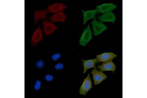 ABIN6261444 and ABIN6277566 staining Hela cells(45 min of heat-shock) by IF/ICC.