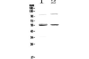 Western blot analysis of Caspase 8 using anti-Caspase 8 antibody . (Caspase 8 抗体  (AA 389-479))