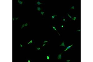 Immunofluorescence staining of SH-SY5Y cells with ABIN7161274 at 1:100, counter-stained with DAPI. (NEFH 抗体  (AA 825-1003))