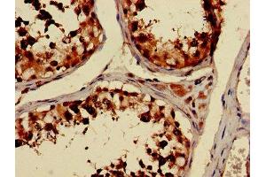 Immunohistochemistry of paraffin-embedded human testis tissue using ABIN7173663 at dilution of 1:100 (TUBA3C 抗体  (AA 161-418))