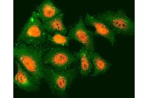 IF analysis of TMOD2 and Tubulin beta using anti-TMOD2 antibody (ABIN7599739) and anti-Tubulin beta antibody (ABIN7602744). (TMOD2 抗体  (AA 111-343))