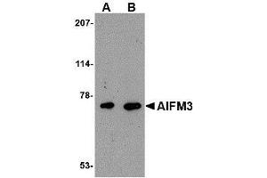 Western blot analysis of AIFM3 in human brain tissue lysate with AIFM3 antibody at (A) 1 and (B) 2 µg/ml. (AIFM3 抗体  (Center))
